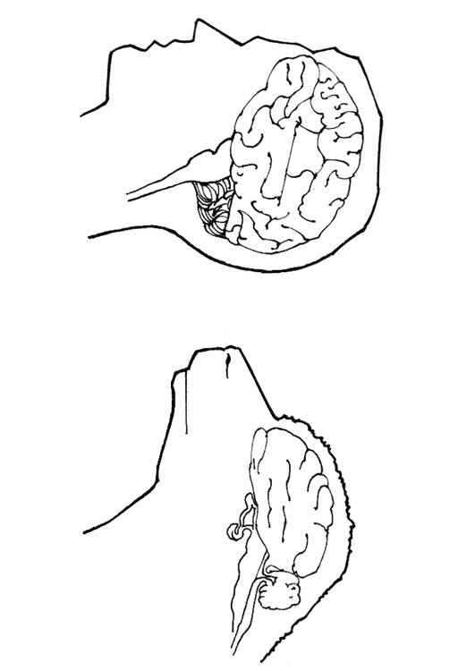 hjerne fra et menneske og en sau